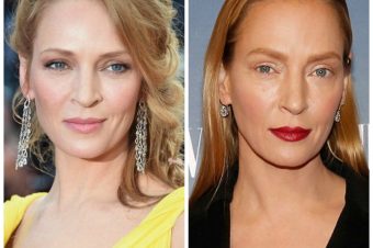 Oh oh What has Uma Thurman done to her face ?